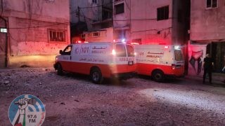 17 إصابة بينها اثنتان بالرصاص الحي في هجوم للمستعمرين جنوب نابلس