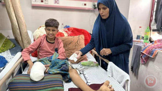 غزة: ارتفاع حالات بتر الأطراف مع انعدام الأدوية والمستلزمات