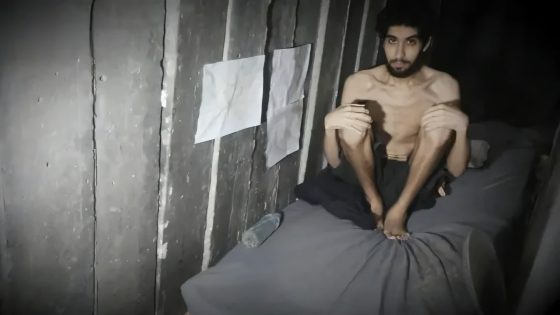 “يأكلون مما نأكل”.. أسير إسرائيلي بجسد هزيل والصحافة الاسرائيلية “يا للعار”
