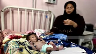 5 وفيات نتيجة المجاعة وسوء التغذية خلال الساعات الـ24 الماضية