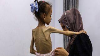 الفاو تحذر: نحن أمام مجاعة كاملة في غزة