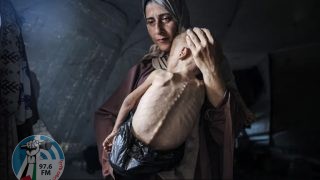 8 وفيات نتيجة المجاعة وسوء التغذية خلال الـ24 ساعة الماضية