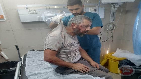 مستوطنون يعتدون بالضرب على مواطن ونجله شرق الخليل