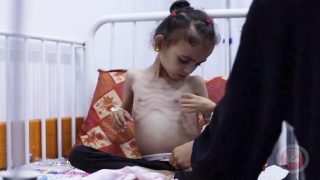 خمسة ضحايا جدد نتيجة الجوع في قطاع غزة يرفع الحصيلة إلى 162