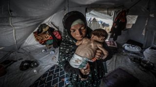 طفلة بوزن 4 كيلوغرامات.. جسد صغير يتآكل بصمت في غزة المجوّعة