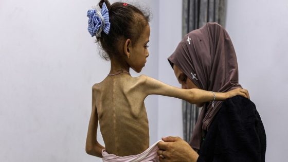 “الأونروا”: يجب اتخاذ إجراءات فورية بشأن الكارثة الإنسانية في غزة