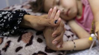 وفاتان نتيجة المجاعة وسوء التغذية بغزة