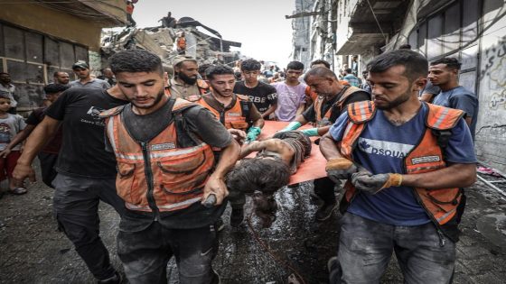 صحة غزة: 44 شهيدا خلال الـ24 ساعة الماضية.