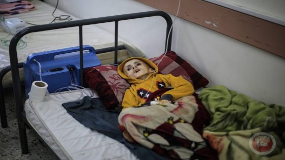 اليونيسيف: سوء التغذية يهدد صحة الأطفال في غزة