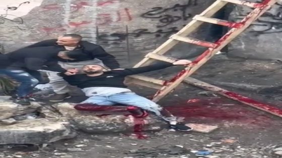 إصابة شاب برصاص الاحتلال في الرام شمال القدس