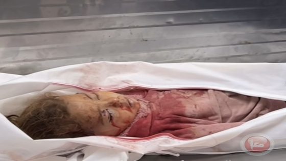 شهيدة واصابات في تجدد الغارات على قطاع غزة