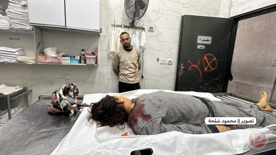 شهداء واصابات بغزة وجباليا والاحتلال يطلق الرصاص على طول الخط الأصفر