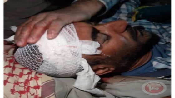 إصابة شابين بالرصاص خلال اقتحام قوات الاحتلال لمدينة الظاهرية