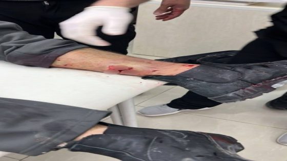 إصابتان برصاص الاحتلال في بلدة الرام