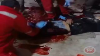 اصابة طفل برصاص الاحتلال في العيزرية