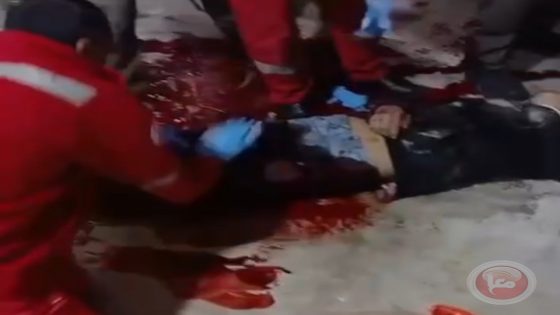اصابة طفل برصاص الاحتلال في العيزرية