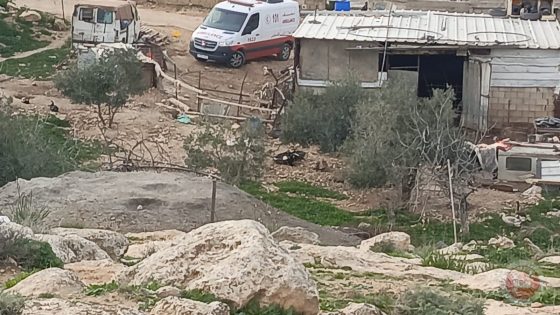إصابات بالاختناق واعتقال شقيقين خلال اعتداءات للمستوطنين وجيش الاحتلال في مسافر يطا