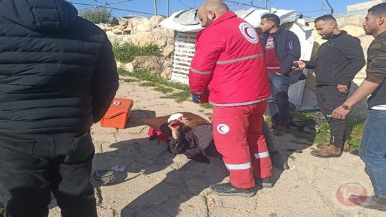 بالصور- إصابتان واعتقال شاب في مسافر يطا جنوب الخليل