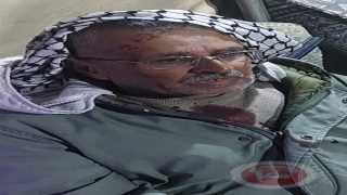 جرحى في هجوم للمستوطنين شرق يطا