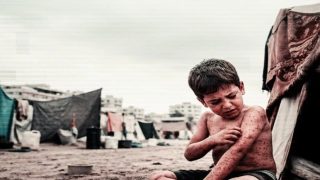 الأونروا تحذر من تفاقم الأمراض الجلدية في غزة