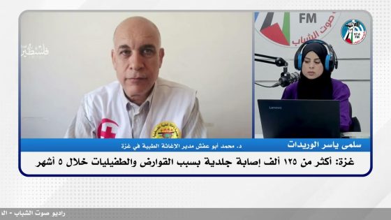 غـ ـزة: أكثر من 125 ألف إصـ ـابة جلدية بسبب القوارض والطفيليات خلال 5 أشهر