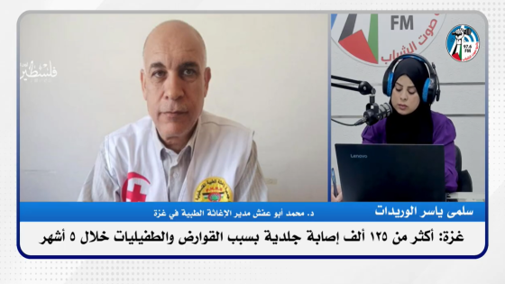 أكثر من 125 ألف إصـابة جلدية بسبب القوارض والطفيليات خلال 5 أشهر